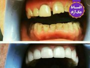 کلیه خدمات دندانپزشکی به صورت اقساطی