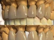 دندانپزشکی و دندانسازی نقد و اقساط